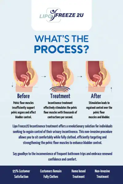 Diagram of how incontinence treatment Elstree works.