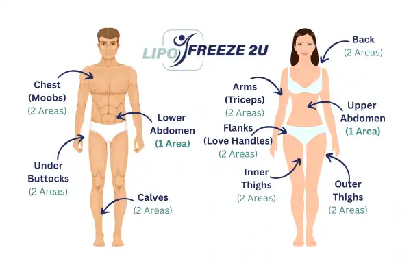 Areas you can have fat freezing treatment Elstree