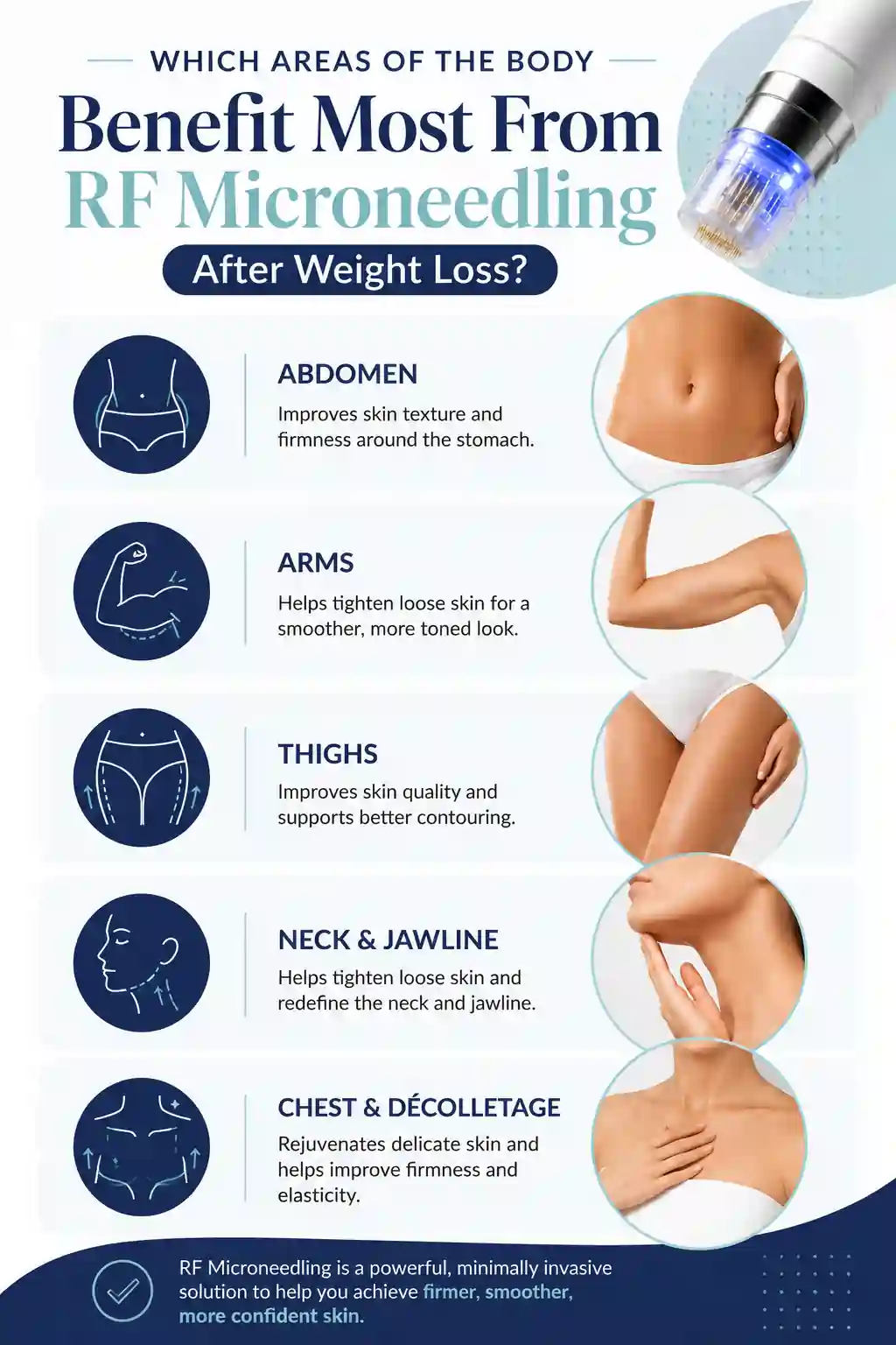 Which Areas of the Body Benefit Most From RF Microneedling After Weight Loss Elstree